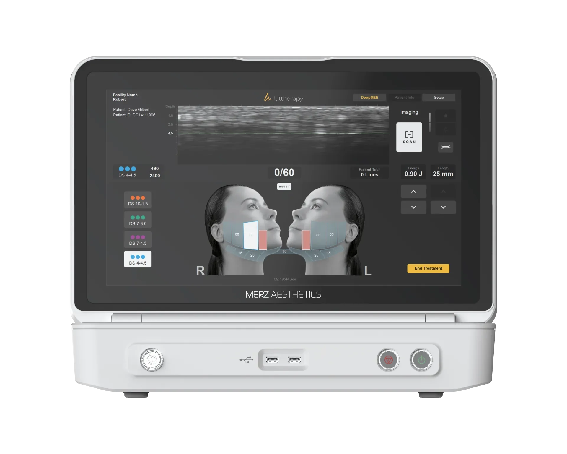 Gangnam Ultherapy Prime — device imagery